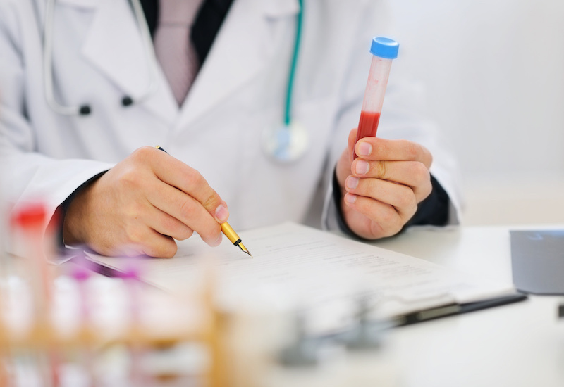 Xét nghiệm Anti HBs là chỉ định thường được áp dụng trong chẩn đoán bệnh viêm gan B