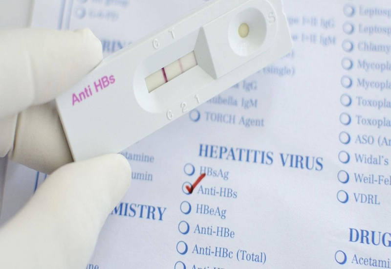 Chỉ số Anti HBs phản ánh mức độ bảo vệ cơ thể trước sự tấn công của virus viêm gan B