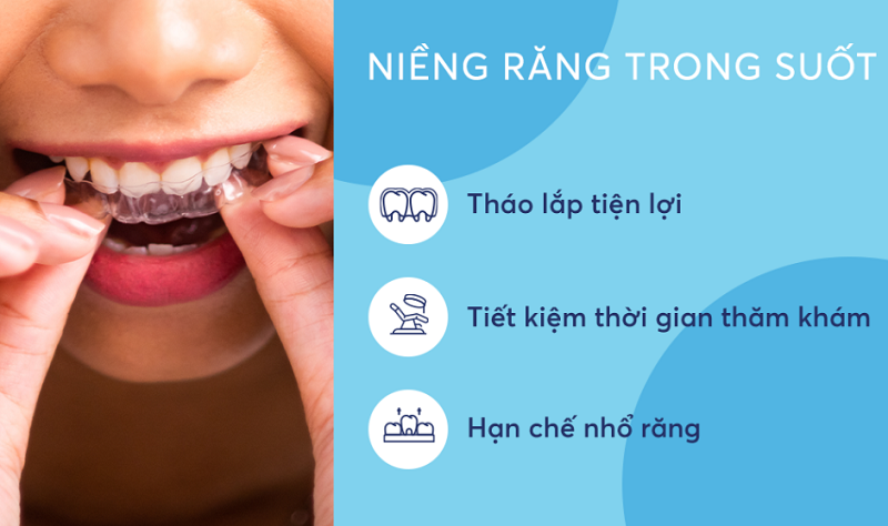 Những ưu điểm của niềng răng trong suốt