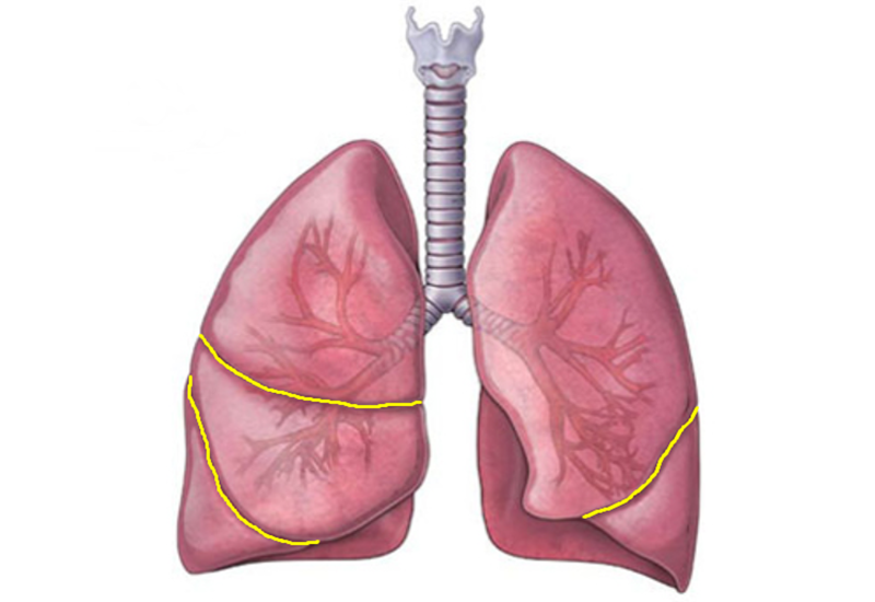 Khe nứt giữa 5 thùy phổi