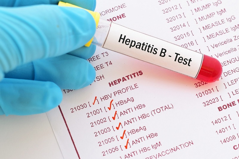 Xét nghiệm HBsAg và HBsAb xác định sự có mặt của kháng thể viêm gan B trước khi tiêm vaccine 