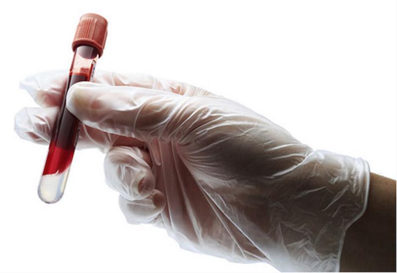 Xét nghiệm máu là một phần không thể thiếu trong khám chữa bệnh lâm sàng 