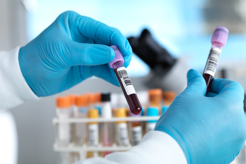 Mức độ bạch cầu ái toan đa nhân được đo trong quá trình xét nghiệm máu 