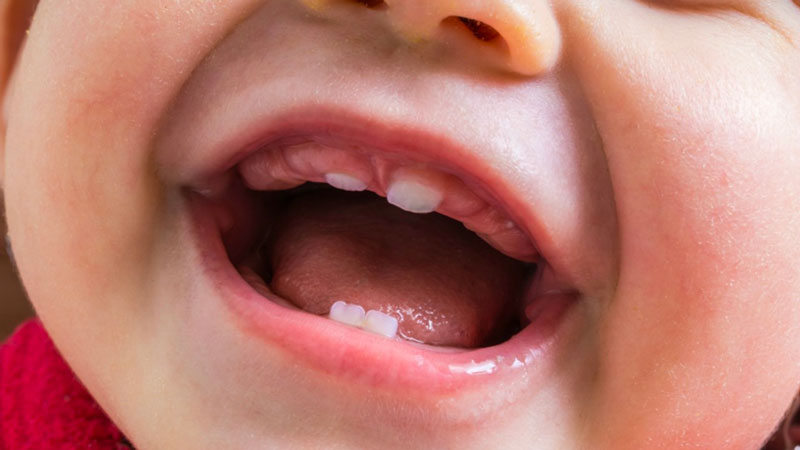Những yếu tố có thể ảnh hưởng đến thời gian mọc răng ở trẻ em