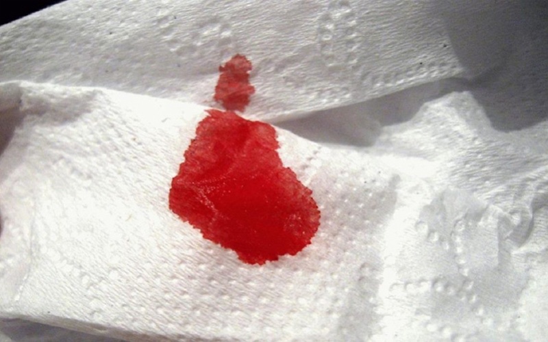 Người bị bệnh lao phổi có biểu hiện ho có kèm theo máu 