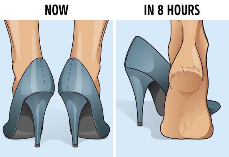 Đi giày cao gót không đúng kích thước quá lâu dễ gây nứt gót chân