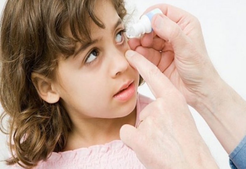 Hãy vệ sinh mắt đúng cách cho bé hàng ngày để phòng bệnh viêm bờ mi