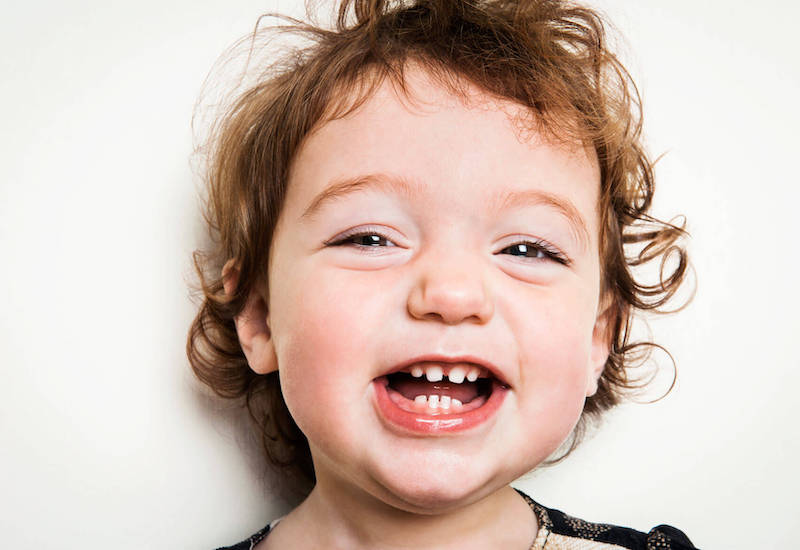 Trẻ rất dễ bị sâu răng sữa do nhiều nguyên nhân khác nhau