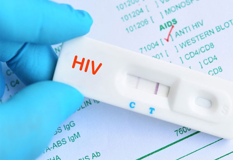 Test nhanh HIV có thể cho kết quả âm tính hoặc dương tính giả
