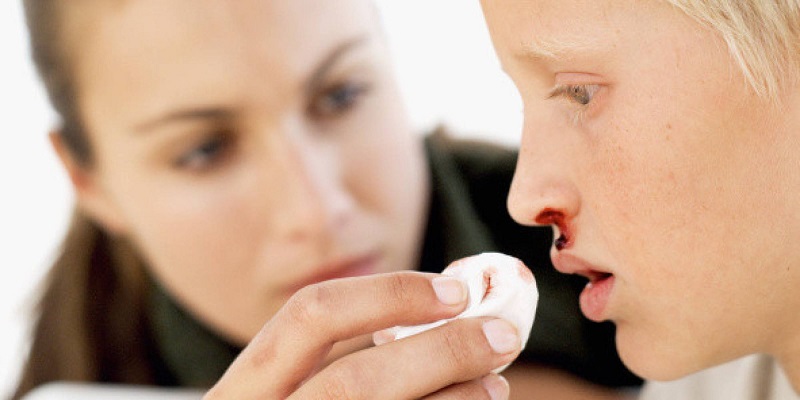 Các tổn thương tại mũi có thể khiến tình trạng nước mũi có máu xuất hiện