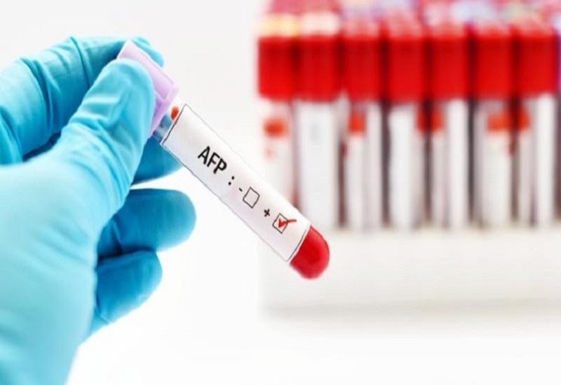 Chỉ số AFP đánh giá nguy cơ ung thư gan