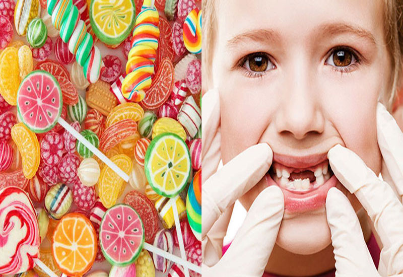 Ăn nhiều đồ ngọt là một trong những nguyên nhân gây sâu răng ở trẻ