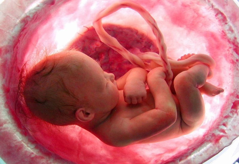Dị tật thai nhi có thể do bất thường về gen