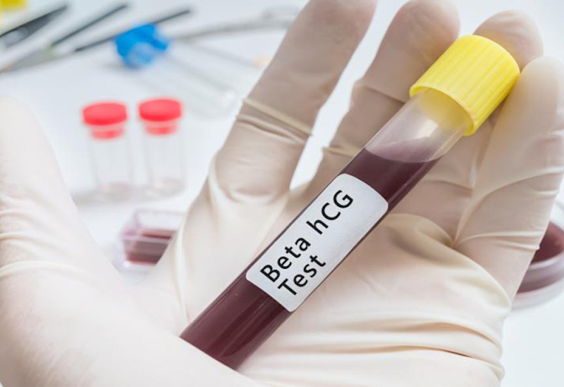 Chỉ số beta HCG có trong nước tiểu hoặc máu giúp xác định người đó có mang thai hay không