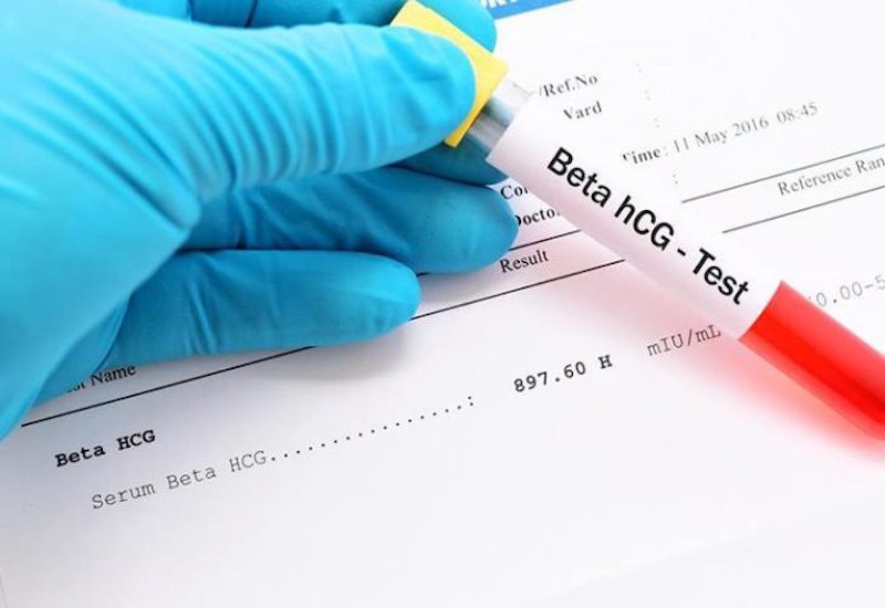 Độ chính xác của xét nghiệm beta HCG khá cao, có thể đạt đến 97%