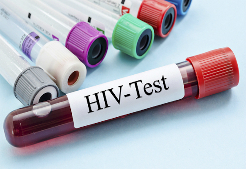 Xét nghiệm HIV thường được chỉ định để phát hiện virus HIV trong cơ thể người