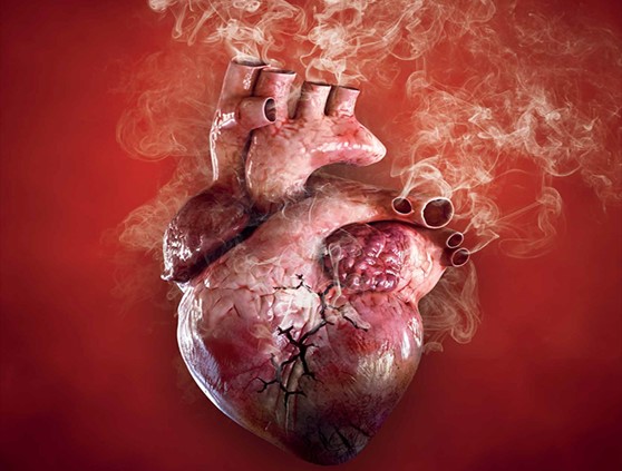 Hút thuốc lá là một trong những thủ phạm gây bệnh mạch vành