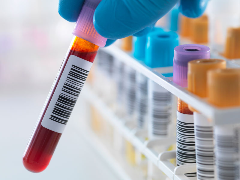 Xét nghiệm tổng thể tế bào máu cho biết nhiều điều về tình trạng bệnh