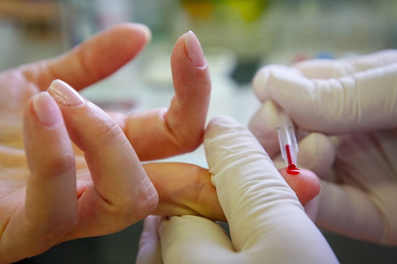 Bạn nên sử dụng dịch vụ xét nghiệm HIV tại nhà của các bệnh viện uy tín