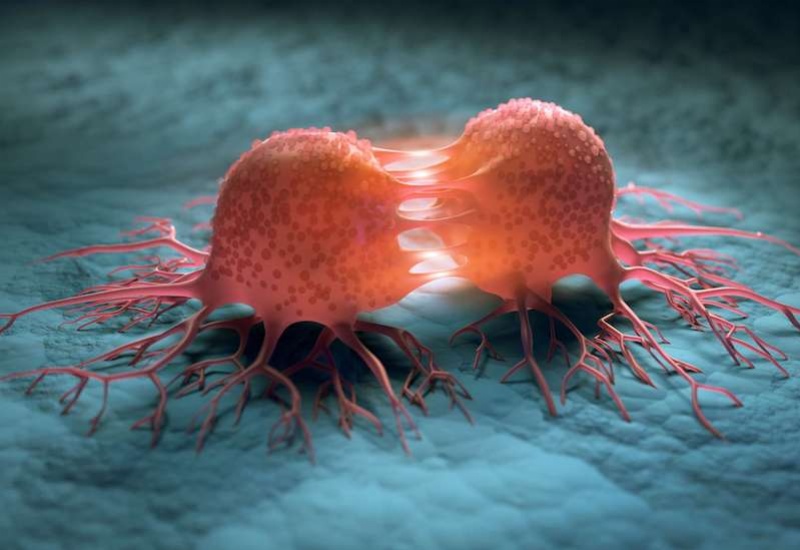 Các tế bào ung thư có thể di căn đến các cơ quan khác 