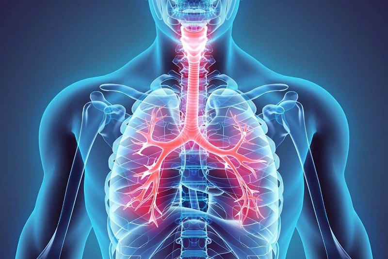 Ho ra đờm xanh có thể là dấu hiệu cảnh báo của tình trạng phổi tắc nghẽn mạn tính bội nhiễm