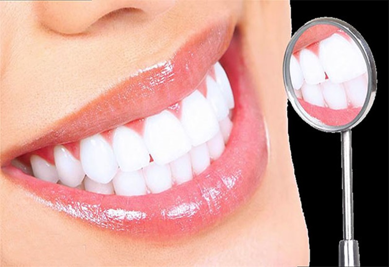 Tẩy trắng răng là phương pháp khá hiệu quả