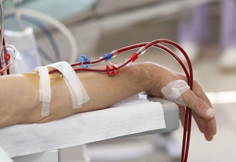 Lọc máu giúp thải độc ra ngoài cơ thể