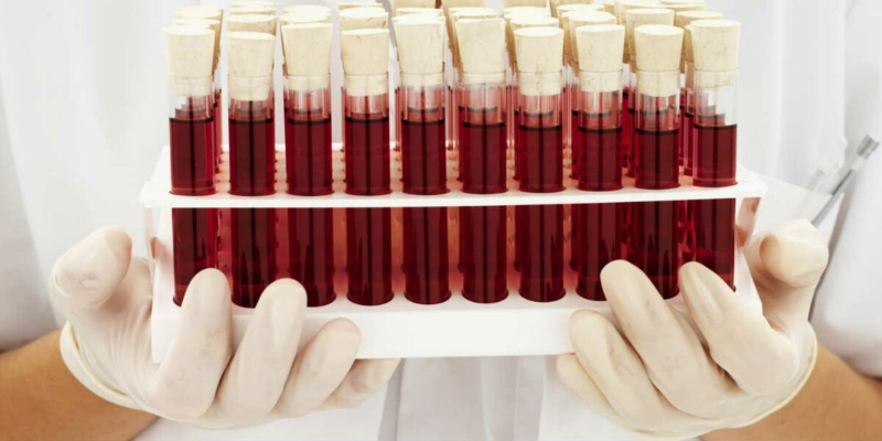 Xét nghiệm máu là một xét nghiệm quan trọng và cần thiết