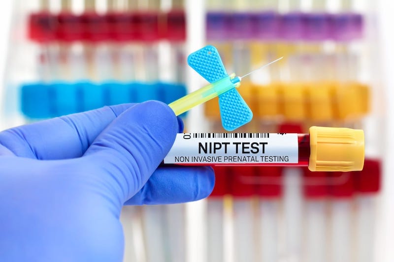 Là một mẫu máu đơn giản, NIPT không gây rủi ro cho thai kỳ