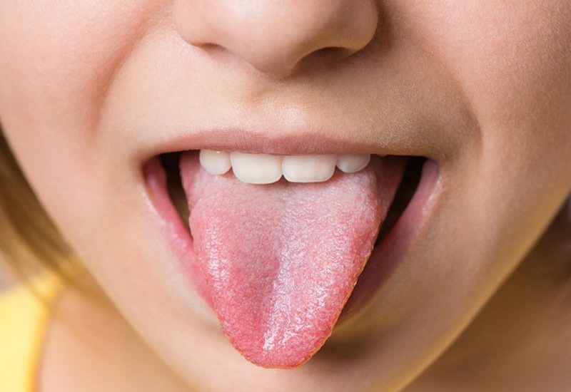 Lưỡi khỏe mạnh thường có màu hồng nhạt hoặc hồng đậm