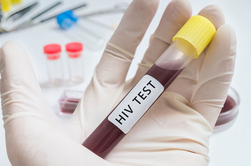 Xét nghiệm Combi PT HIV thực hiện sau thời điểm có hành vi nghi nhiễm 2 - 3 tuần, chính xác 95%