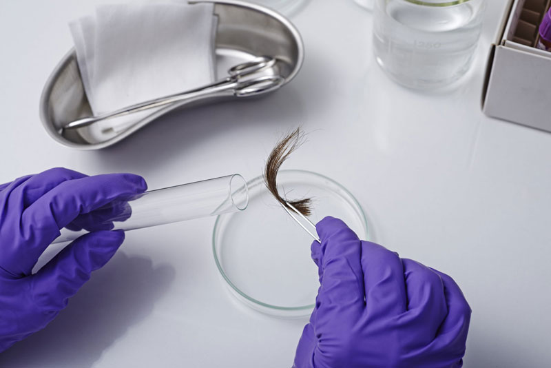 Bạn phải chuẩn bị cọng tóc kèm chân tóc để xét nghiệm ADN chính xác nhất