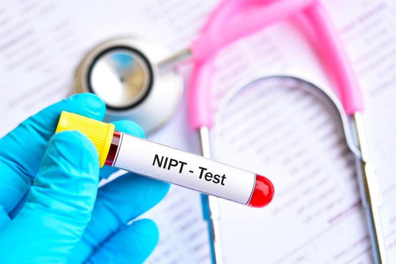 Xét nghiệm NIPT sử dụng trực tiếp mẫu máu của mẹ bầu