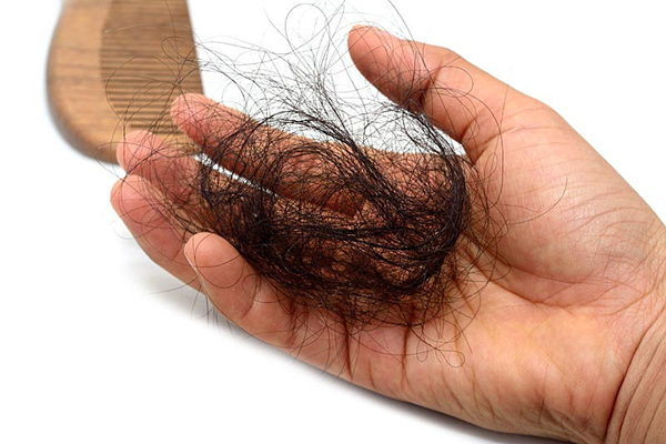 Rụng tóc là tác dụng phụ phổ biến khi áp dụng phương pháp hóa trị