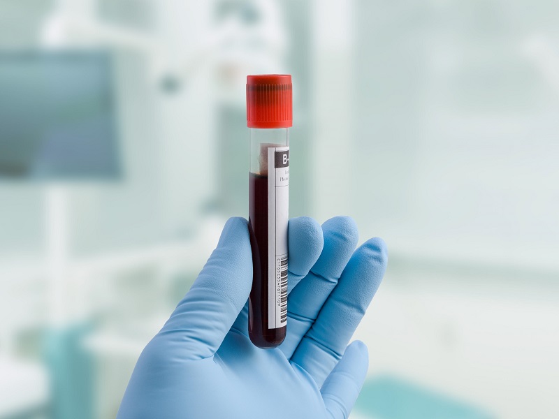 Xét nghiệm máu giúp kiểm tra nhiều thông số liên quan tới tuyến giáp