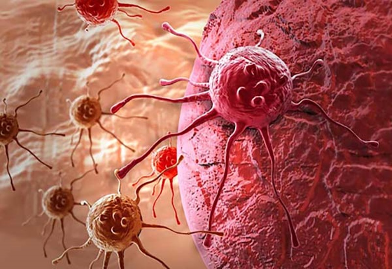 Những tế bào ung thư xâm lấn khiến việc điều trị khó khăn hơn