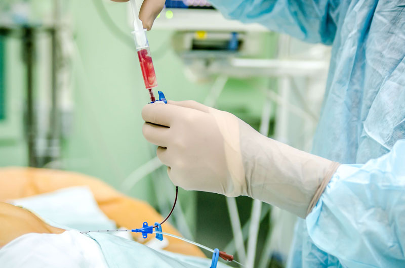 Phương pháp đặt catheter tĩnh mạch sở hữu nhiều ưu điểm vượt trội