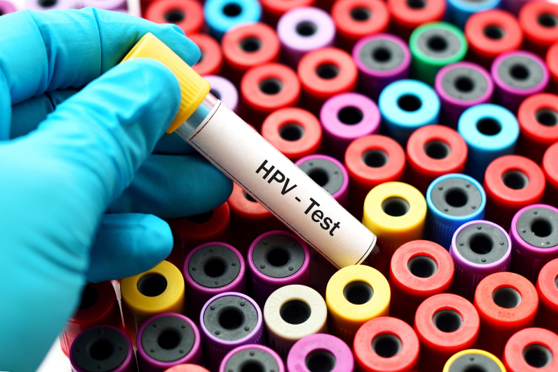 Xét nghiệm HPV là một phương tiện phát hiện sớm cho phép kiểm tra, điều trị 