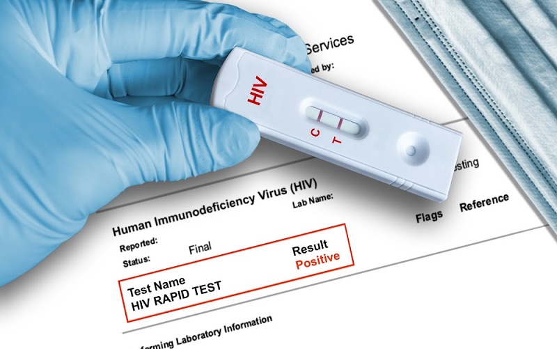 Xét nghiệm HIV sau 2-3 nghi nhiễm sẽ cho kết quả chính xác nhất 