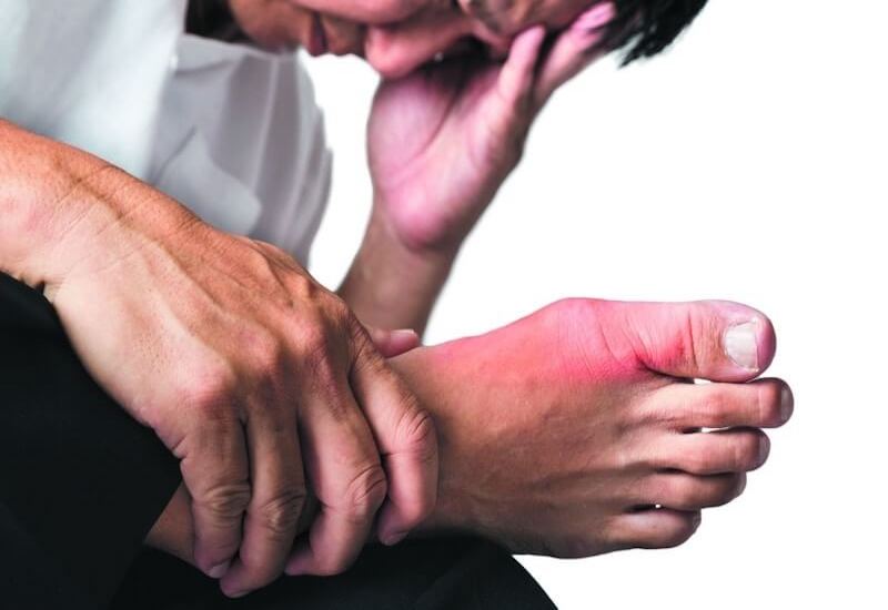 Bệnh Gout nếu không được điều trị sẽ gây không ít đau đớn cho người bệnh