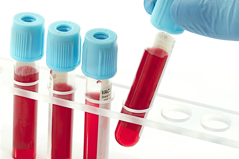 Xét nghiệm sinh hóa nhằm xác định định lượng các hợp chất có trong máu