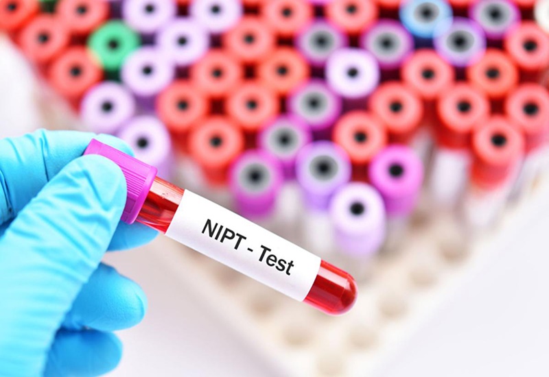 Xét nghiệm NIPT đơn giản và dễ thực hiện
