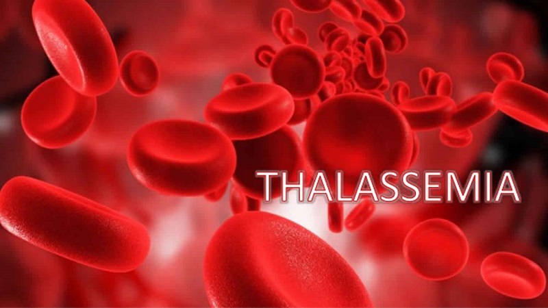 Thalassemia là tình trạng tan máu bẩm sinh do bất thường trong tổng hợp Globin