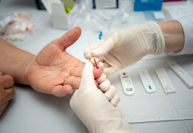 Lấy mẫu máu xét nghiệm HIV COMBO