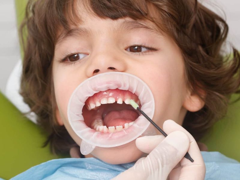 Chăm sóc răng miệng đúng cách cho con