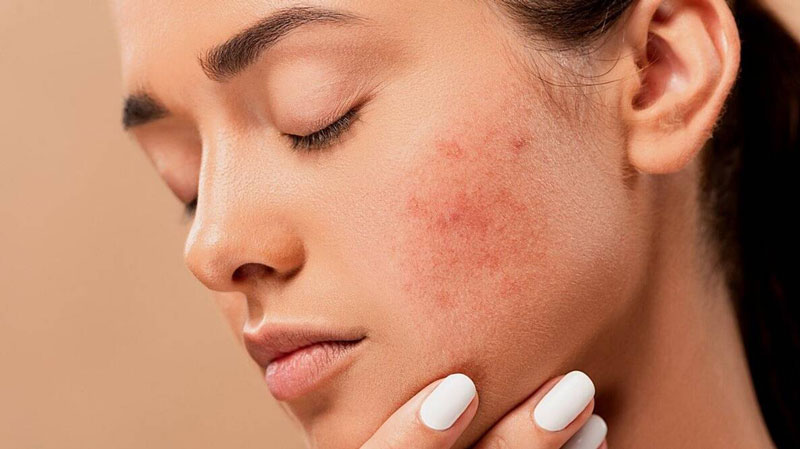 Vùng da mặt thường nhạy cảm và dễ bị sần, khô ráp