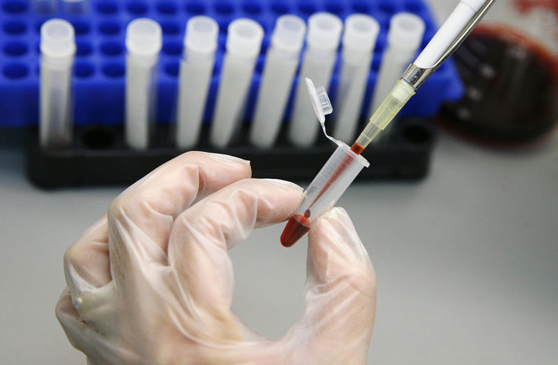 Test PCR cho phép xác định đặc điểm gen HPV - DNA