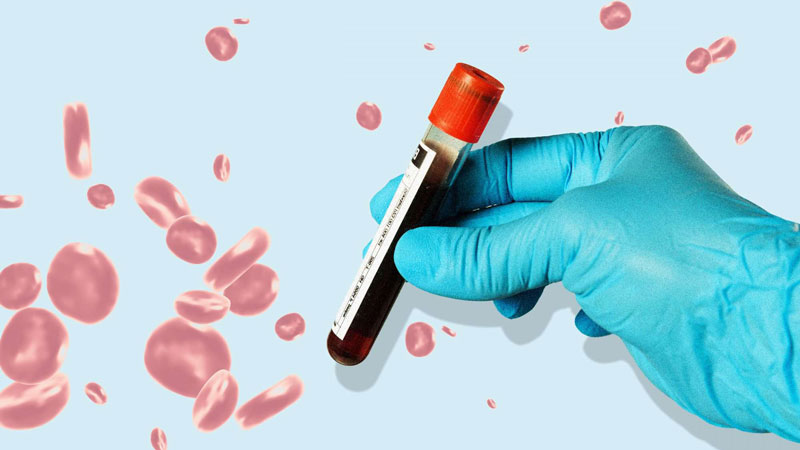 Kết quả xét nghiệm máu giúp bác sĩ phát hiện nhiều vấn đề sức khỏe