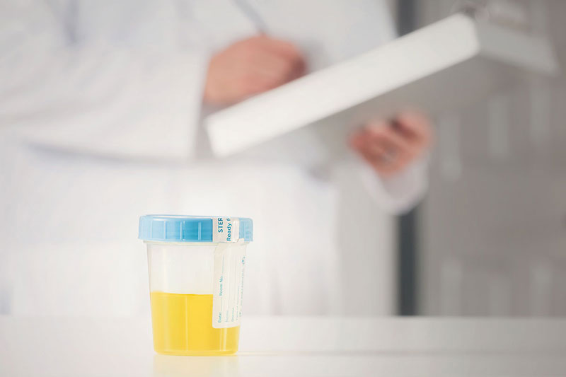 Xét nghiệm nước tiểu là một trong những xét nghiệm phổ biến trong các dịch vụ xét nghiệm MEDLATEC Hà Tĩnh
