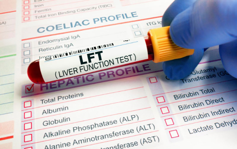 Bạn nên biết các loại xét nghiệm kiểm tra chức năng của gan